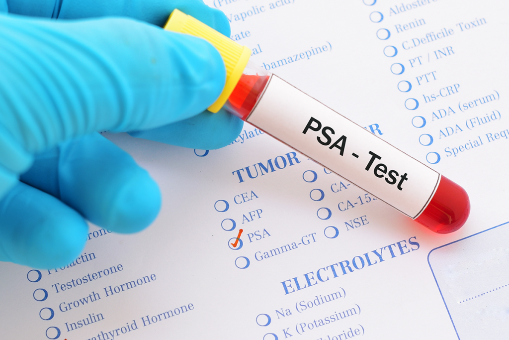 PSA test vial